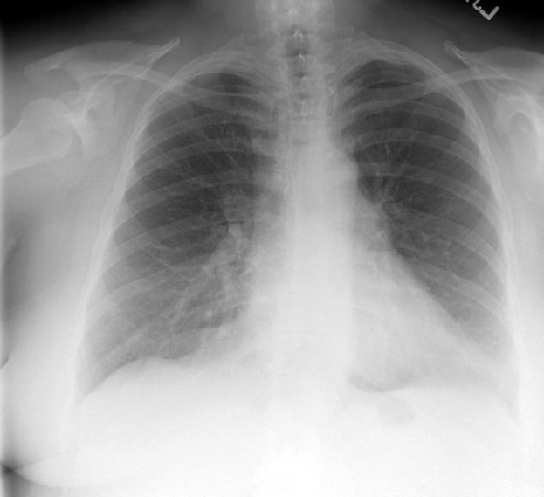 Chest Radiology