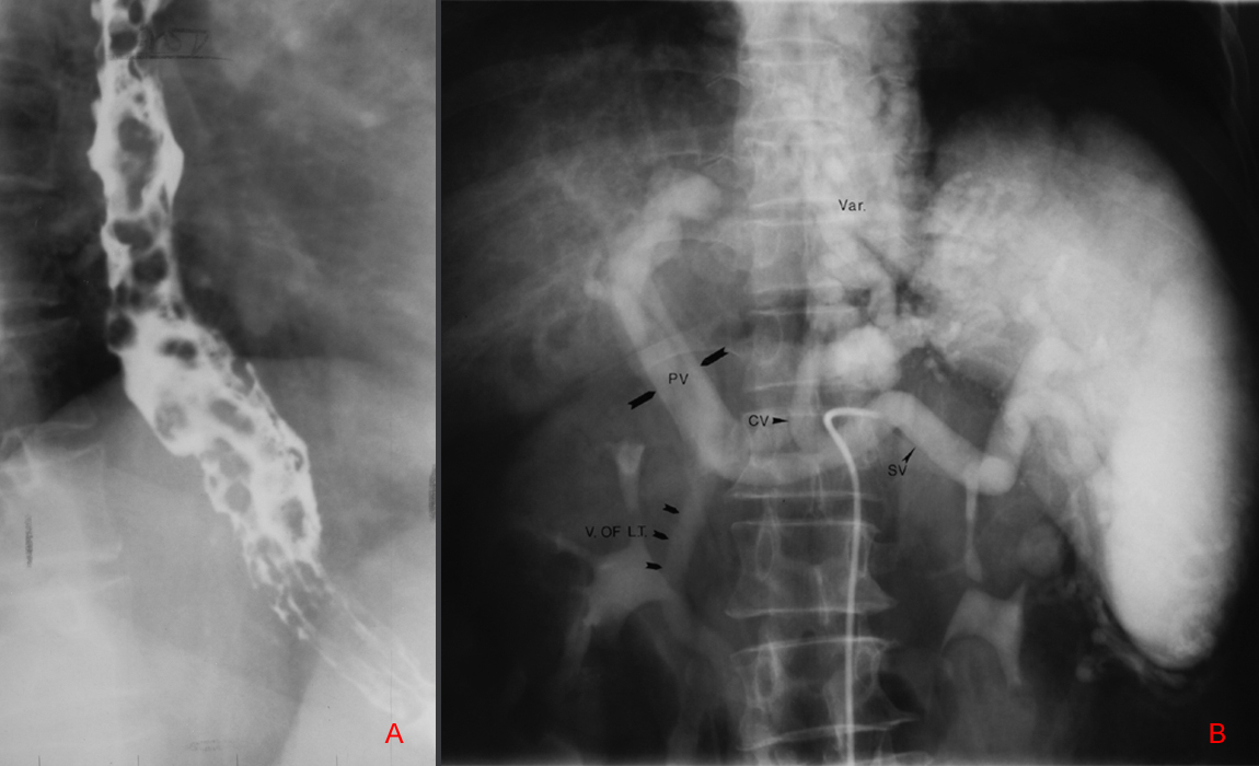 Gastrointestinal Radiology