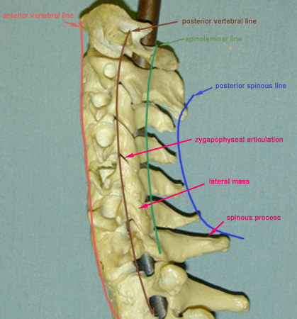 lateral view of cervical spine x ray