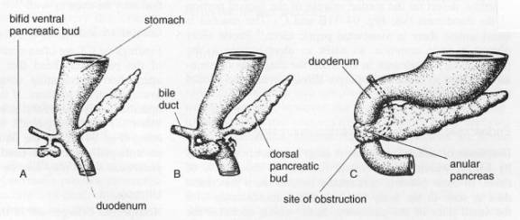 annular pancreas ultrasound