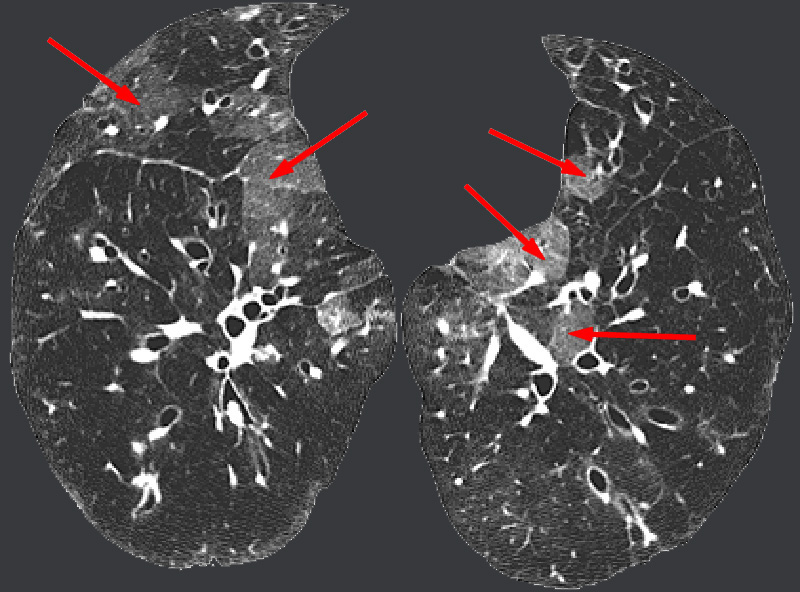 chest-radiology