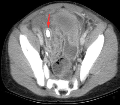 Pediatric Radiology